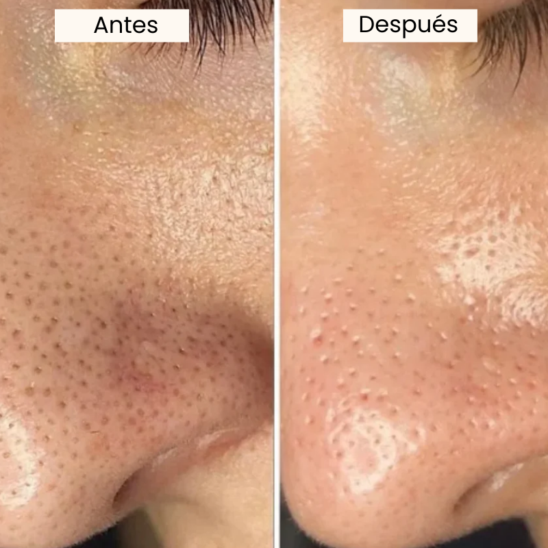 Suero Exfoliante e Iluminador Coreano de Arroz