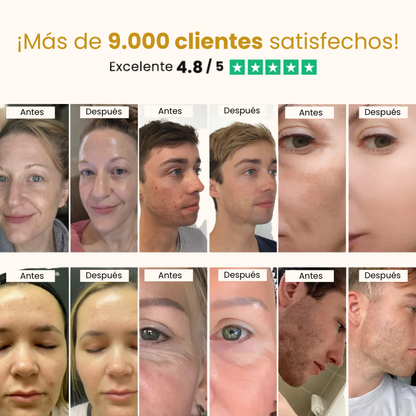 Suero Exfoliante e Iluminador Coreano de Arroz