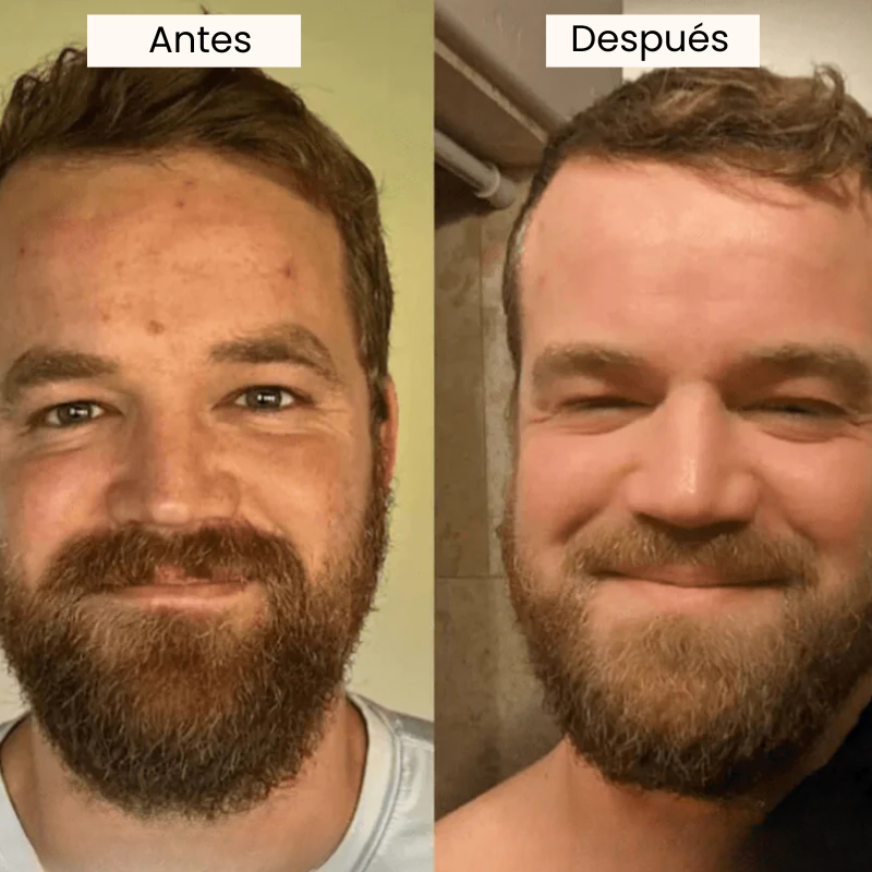 Suero Exfoliante e Iluminador Coreano de Arroz