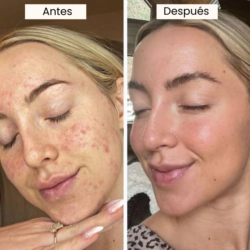 Suero Exfoliante e Iluminador Coreano de Arroz